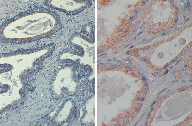 AKT1 Antibody (phospho-Thr308, clone 18F3.H11, Biotin)