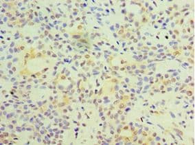 FOSL2 / FRA-2 Antibody (aa187-326)