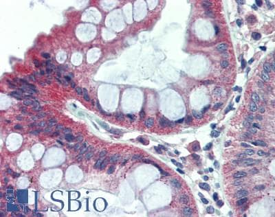 IHC-plus™ DLG1 / SAP97 Antibody (aa50-100)