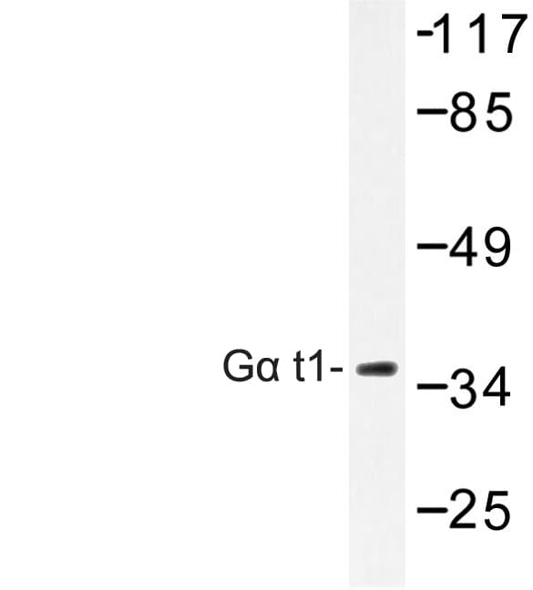 GNAT1 Antibody (Met104)