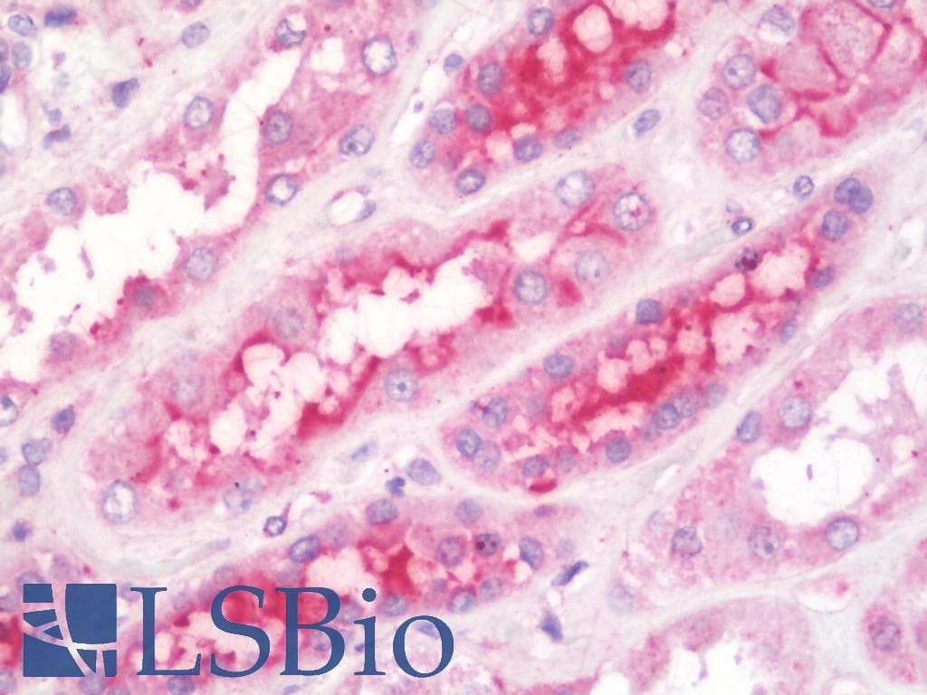 IHC-plus™ Polyclonal Rabbit anti-Human GIT2 Antibody (IHC, WB)