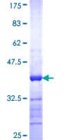 Human CPXM1 / CPXM Protein (Recombinant GST, N-terminus)