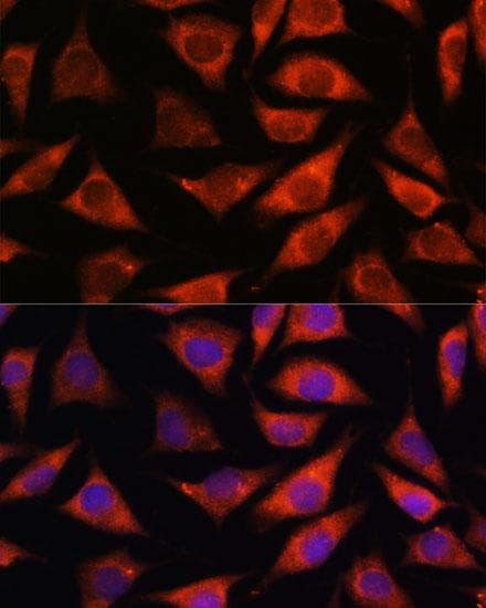 TMX2 / TXNDC14 Antibody