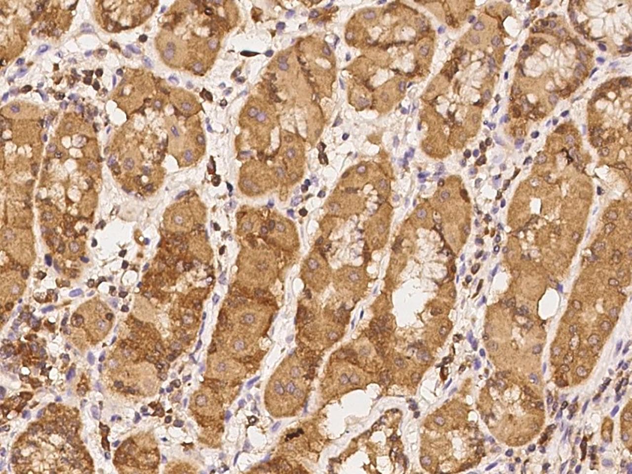 TSTD1 Antibody