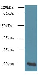 Polyclonal Rabbit anti-Human NUDT11 Antibody (IHC, WB)