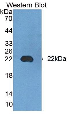 ADGRE2 / EMR2 Antibody (aa347-509)