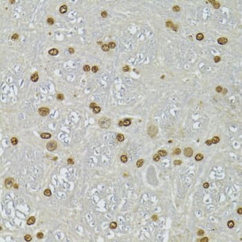 CDX2 Antibody