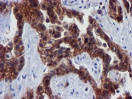 EPN2 Antibody (clone OTI1F5)