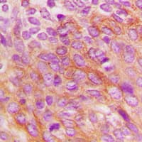 EIF2AK2 / PKR Antibody (C-Terminus)