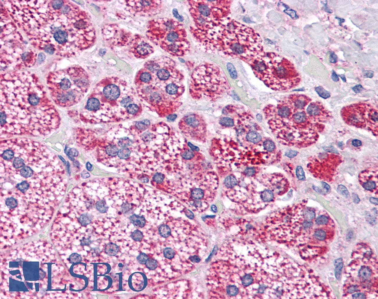 PathPlus™ PDGFRA / PDGFR Alpha Antibody
