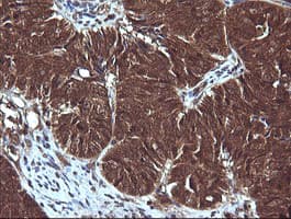 SYP / Synaptophysin Antibody (clone OTI1B10, Carrier-free)