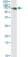 Monoclonal Mouse anti-Human Alpha-Fetoprotein Antibody (clone 1G7, IF, WB)