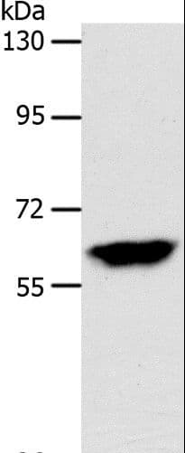 INA / Alpha Internexin Antibody