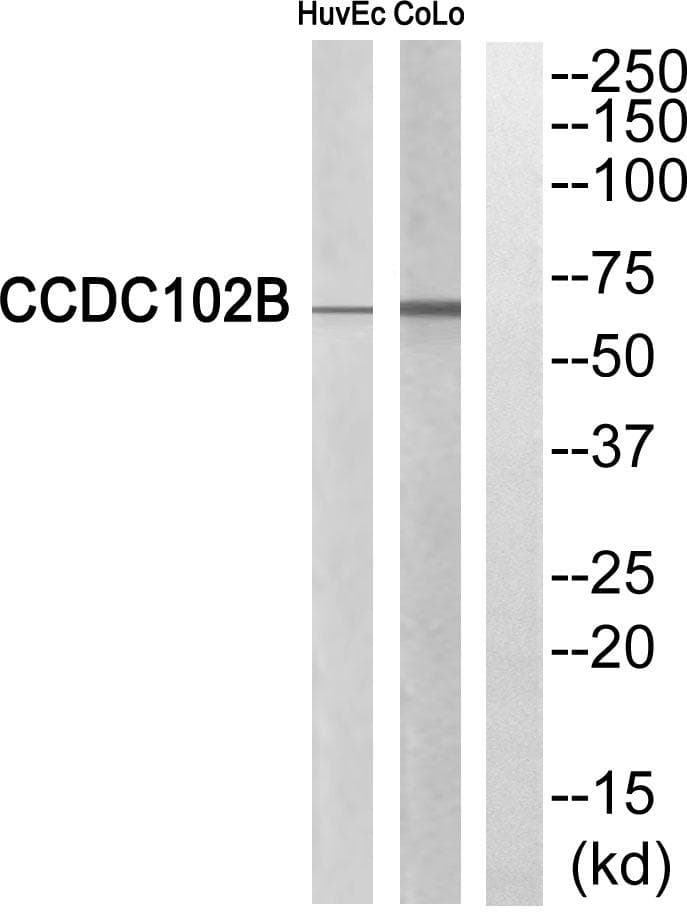 CCDC102B Antibody