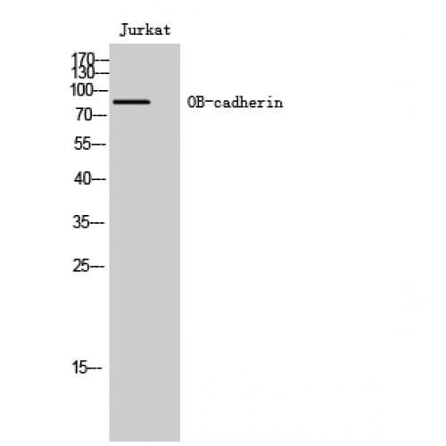 Polyclonal Rabbit anti-Human CDH11 / Cadherin 11 Antibody (390-470 aa, Internal, WB)