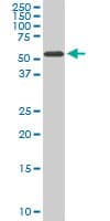 IHC-plus™ HDAC1 Antibody (clone 1D6)