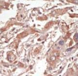 Polyclonal Rabbit anti-Human STK10 / LOK Antibody (aa692-721, IHC, WB)