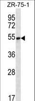 SEC62 / TP-1 Antibody (aa1-30)