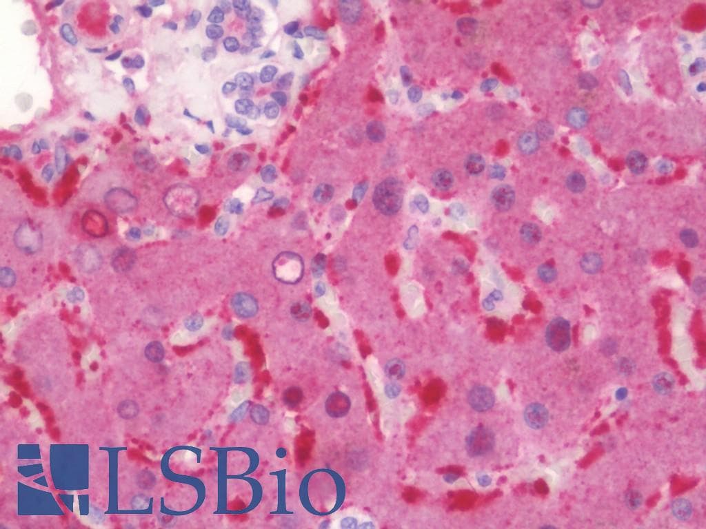 IHC-plus™ Polyclonal Rabbit anti-Human ANGPT1 / Angiopoietin-1 Antibody (aa176-224, IHC, WB)
