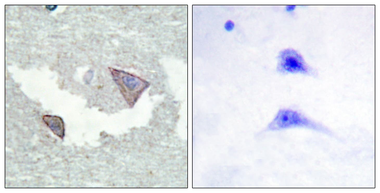 PDGFRA / PDGFR Alpha Antibody (phospho-Tyr754)