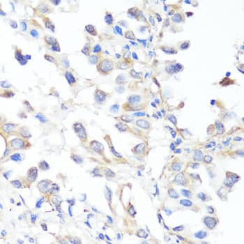 EGFR Antibody