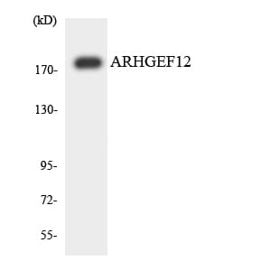 IHC-plus™ ARHGEF12 Antibody (aa435-484)