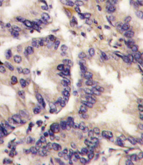 VEGFC Antibody (aa248-277)