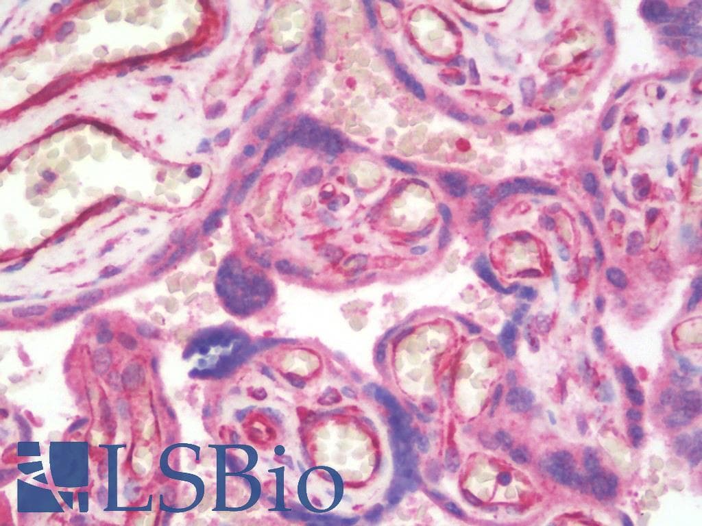 IHC-plus™ PIBF1 / PIBF Antibody