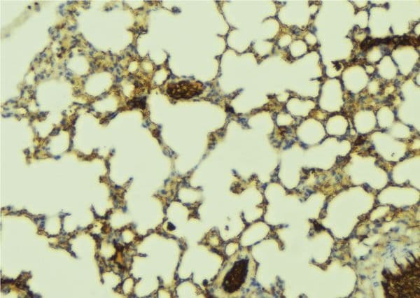 PDZK1 Antibody