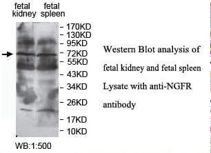 NGFR / CD271 / TNR16 Antibody (C-Terminus)