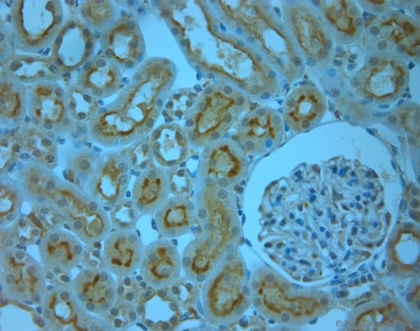 SLC6A8 Antibody (aa580-630)