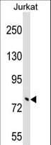 Polyclonal Rabbit anti-Human TRIM46 Antibody (aa75-104, WB)