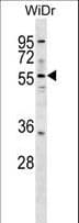 Polyclonal Rabbit anti-Human ASNS Antibody (aa120-147, WB)