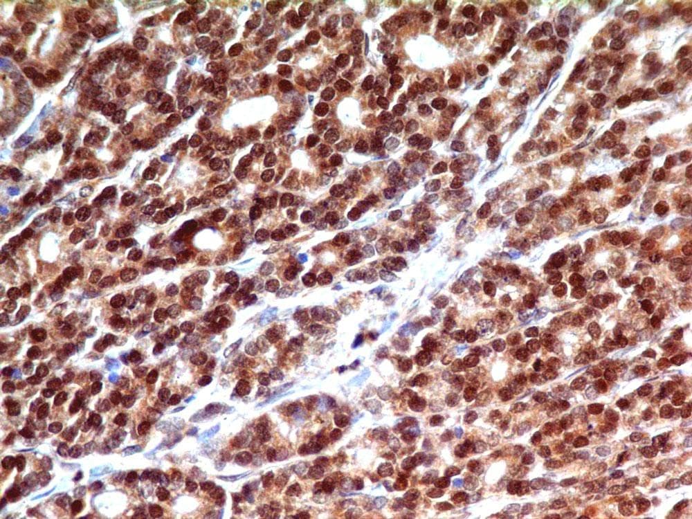 Monoclonal Mouse anti-Mouse IKBKE / IKKI / IKKE Antibody (IHC, WB)
