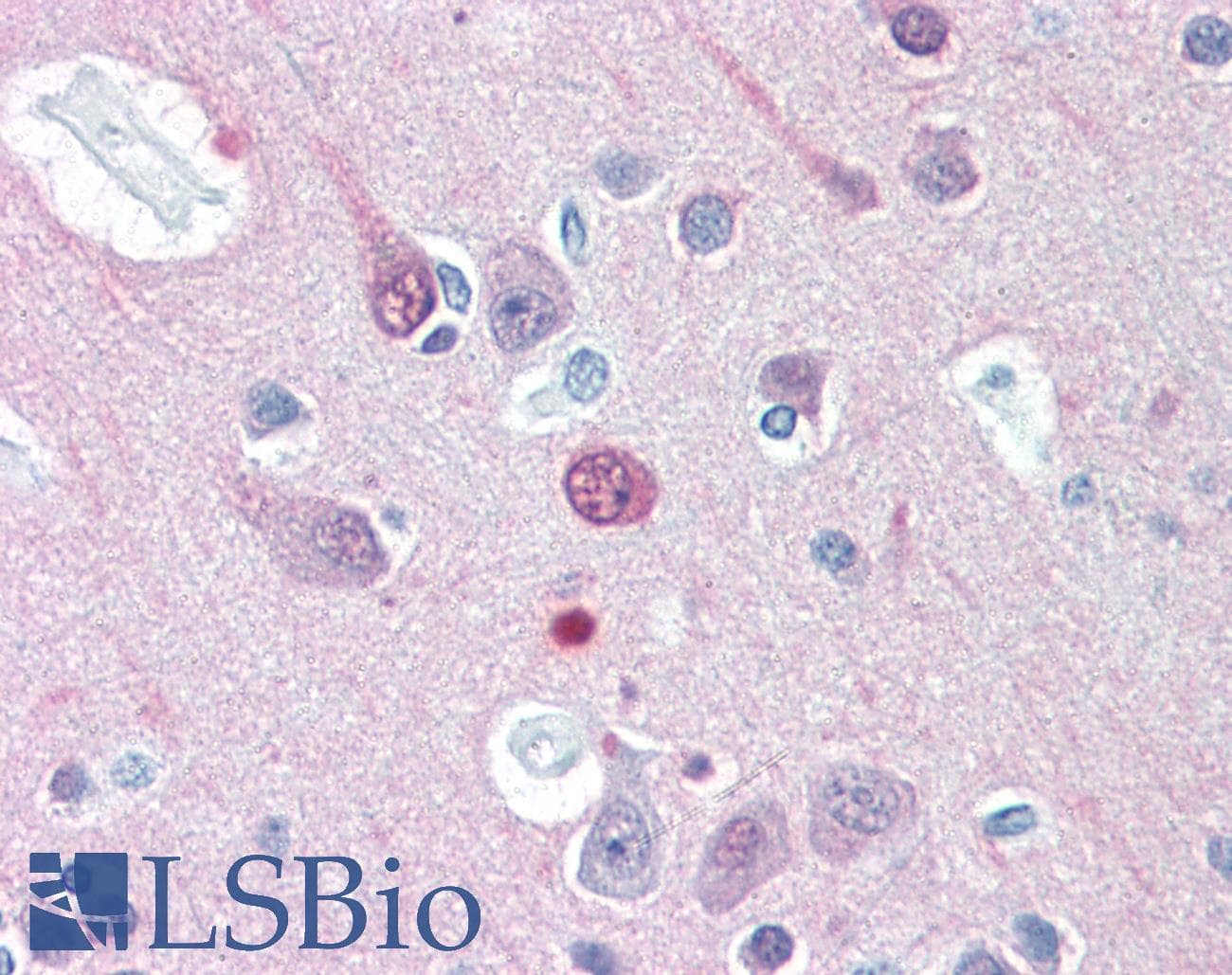 IHC-plus™ Polyclonal Chicken anti-Human UCHL1 / PGP9.5 Antibody (IHC, IF, WB)