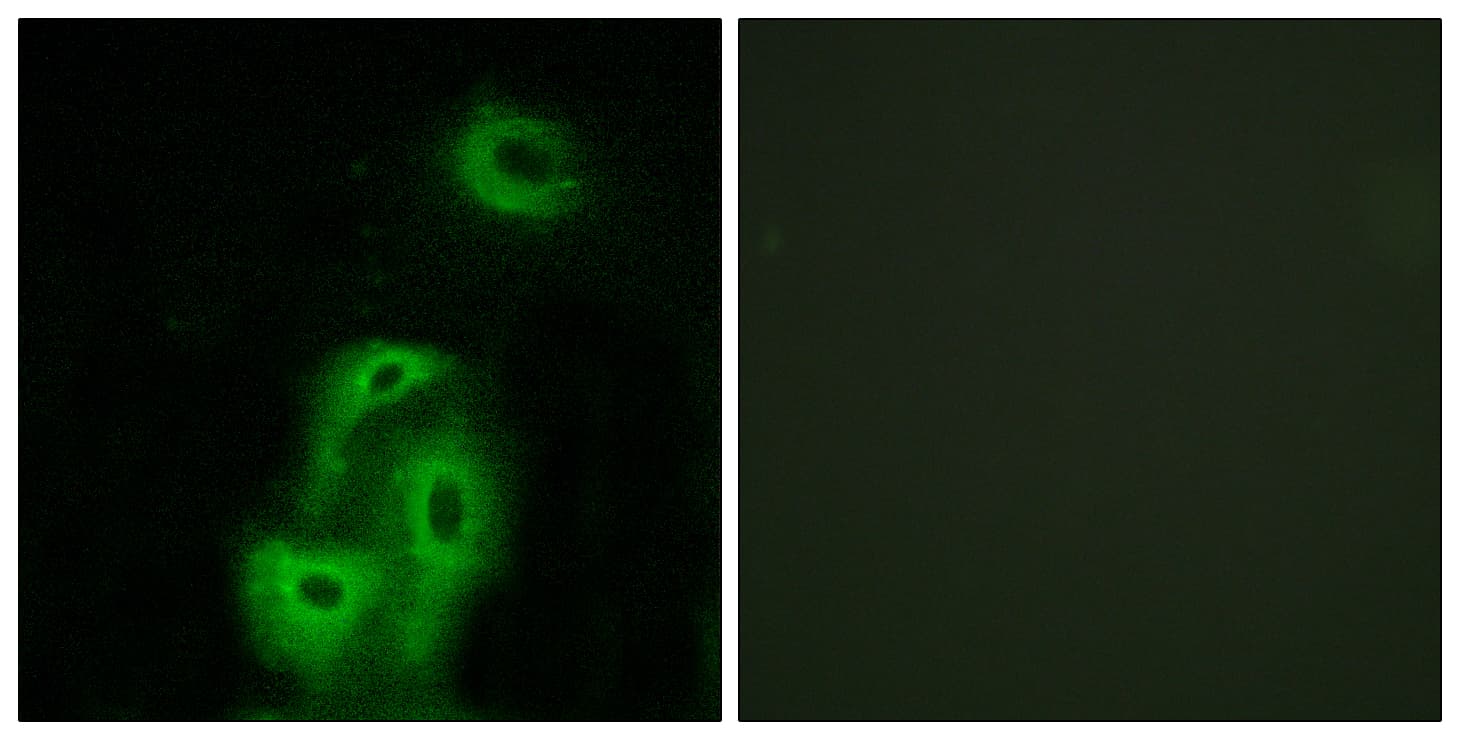 HTR2A / 5-HT2A Receptor Antibody (aa422-471)