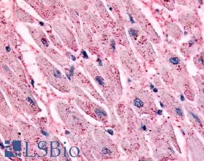 IHC-plus™ Polyclonal Rabbit anti-Human ADRB2 Antibody (Transmembrane Domain, IHC)