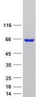 Human SETD3 Protein (Recombinant Myc-DDK (Flag))