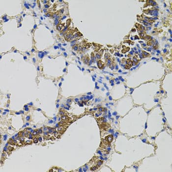 Polyclonal Rabbit anti-Human CKAP4 Antibody (AP, IHC, WB)