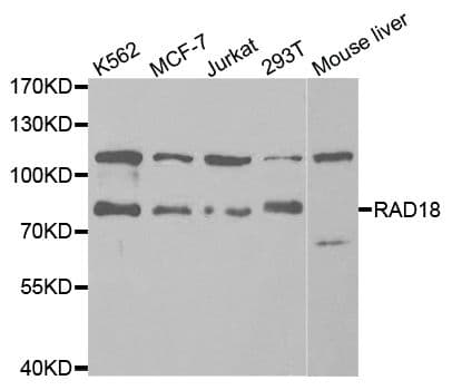Polyclonal Rabbit anti-Human RAD18 Antibody (IHC, IF, WB)