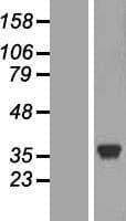 LDHC / Lactate Dehydrogenase C Protein (Over-Expression Lysate Myc-DDK (Flag))