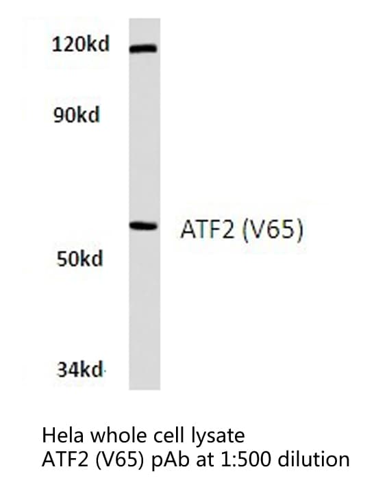 Polyclonal Rabbit anti-Human ATF2 Antibody (Val65/47, IHC, WB)