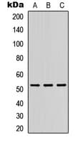 Polyclonal Rabbit anti-Human DMRTA1 Antibody (Internal, WB)