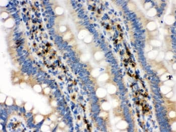 Polyclonal Rabbit anti-Human IDH2 Antibody (IHC, WB)