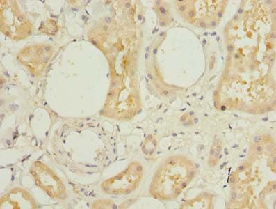 Polyclonal Rabbit anti-Human L3HYPDH / C14orf149 Antibody (IHC, WB)