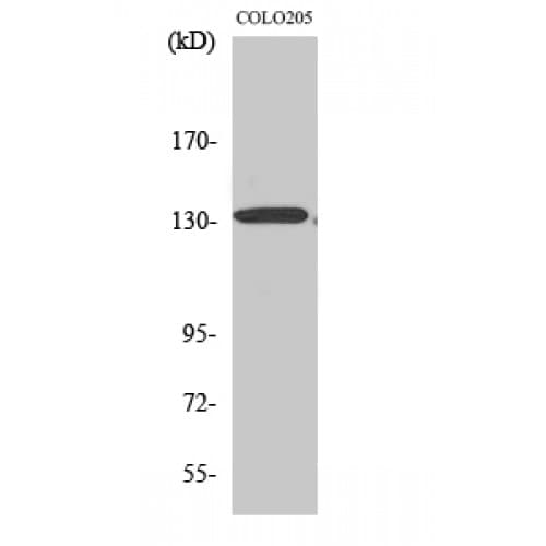 CARMA1 / CARD11 Antibody (10-90 aa, N-terminal)