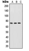 RELA / NFKB p65 Antibody (phospho-Ser468)