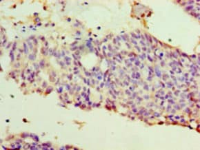 Polyclonal Rabbit anti-Human WT1 / Wilms Tumor 1 Antibody (aa1-449, IHC)