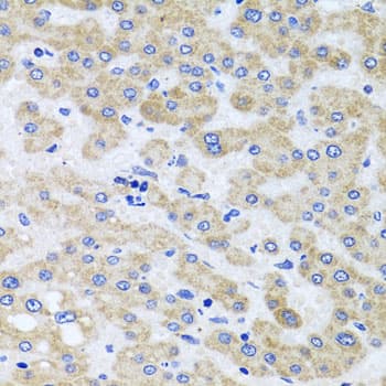 Polyclonal Rabbit anti-Human PEX3 Antibody (IHC, WB)