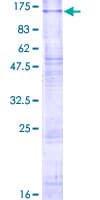 Human CLCN6 Protein (Recombinant GST)